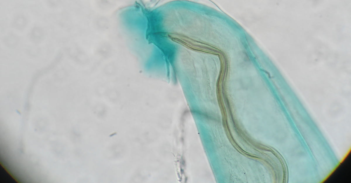 angiostrongylus-cantonensis