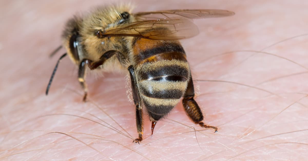 bee-sting