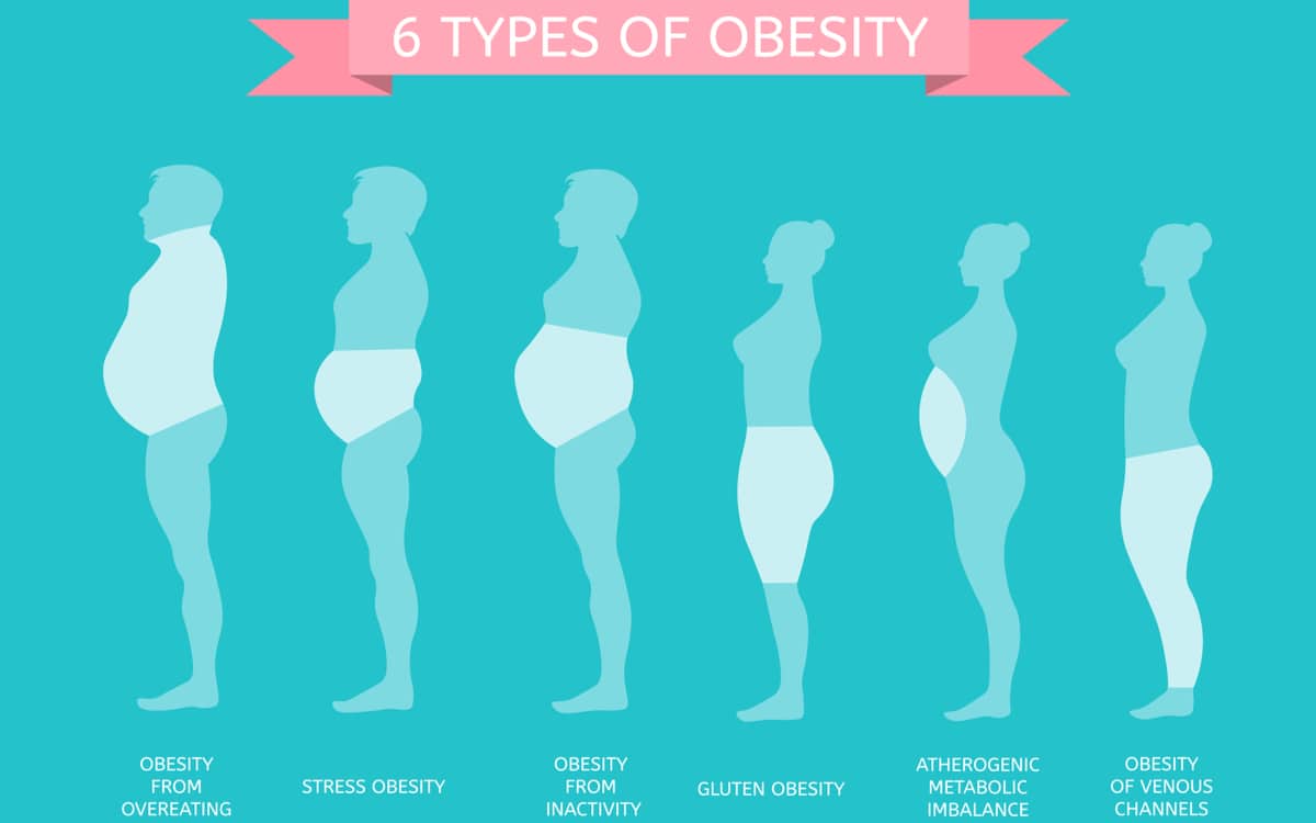 6-types-of-obesity
