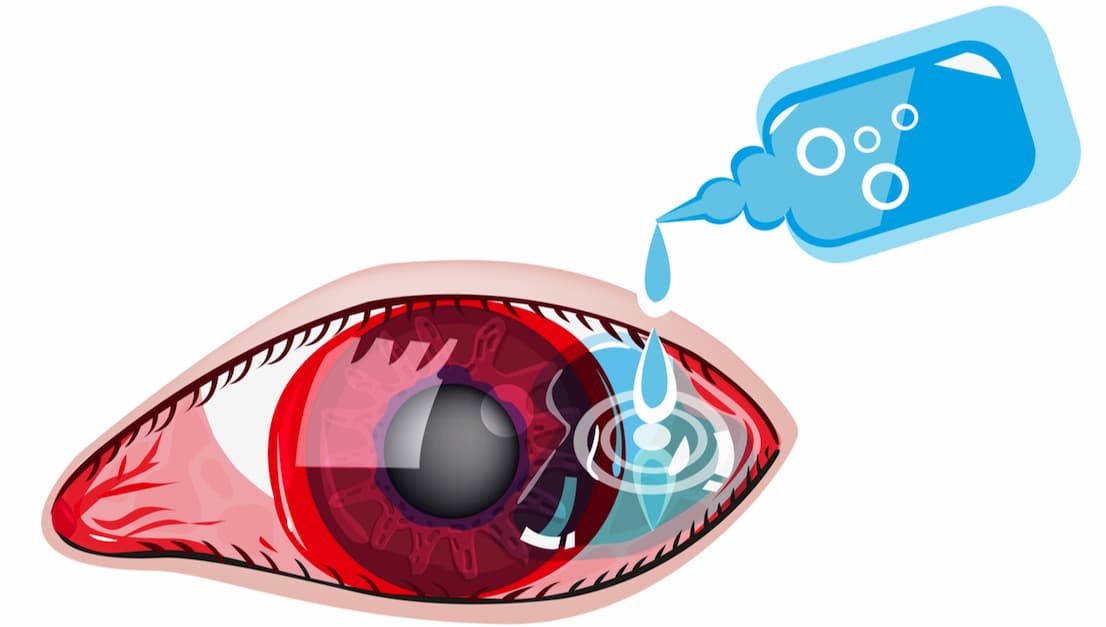 artificial-tears