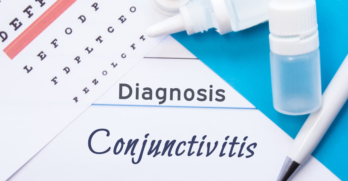 diagnosis-of-conjunctivitis