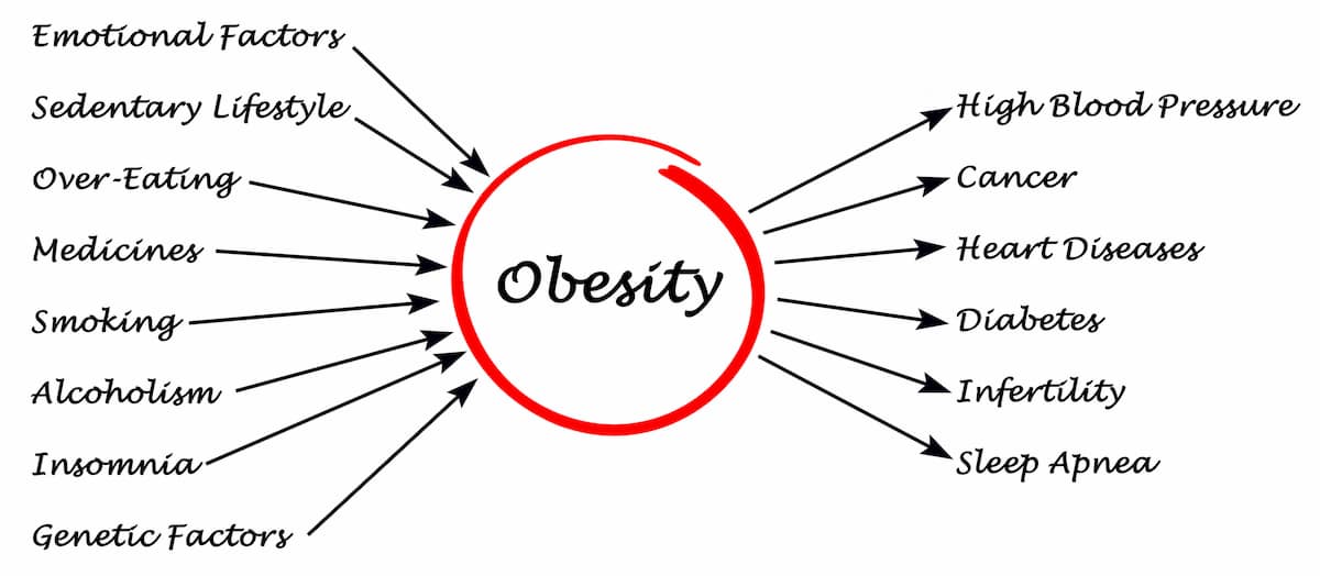 obesity-causes-and-effects
